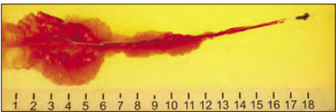 Steel gel image